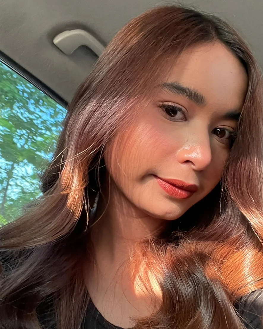 ชาวเซ็นทรัลอีสต์วิลล์ ต้องรู้ เติมคางสวยเป็นธรรมชาติ ใกล้บ้าน ราคาเพียง 8,999
