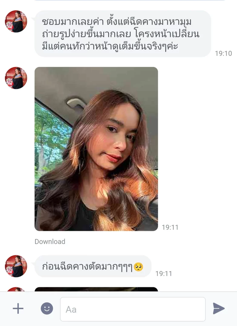 โปรโมชั่นฟิลเลอร์คาง 8,999 บาท พิกัด Paseo Town รามคำแหง รับเคสจำกัด