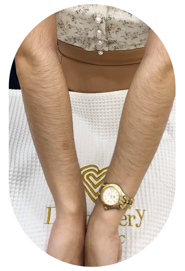 พิกัดลับผิวสวย เลเซอร์ขน CDC เลียบด่วน โปรโมชั่น 5 ครั้ง คุ้มกว่าเยอะ