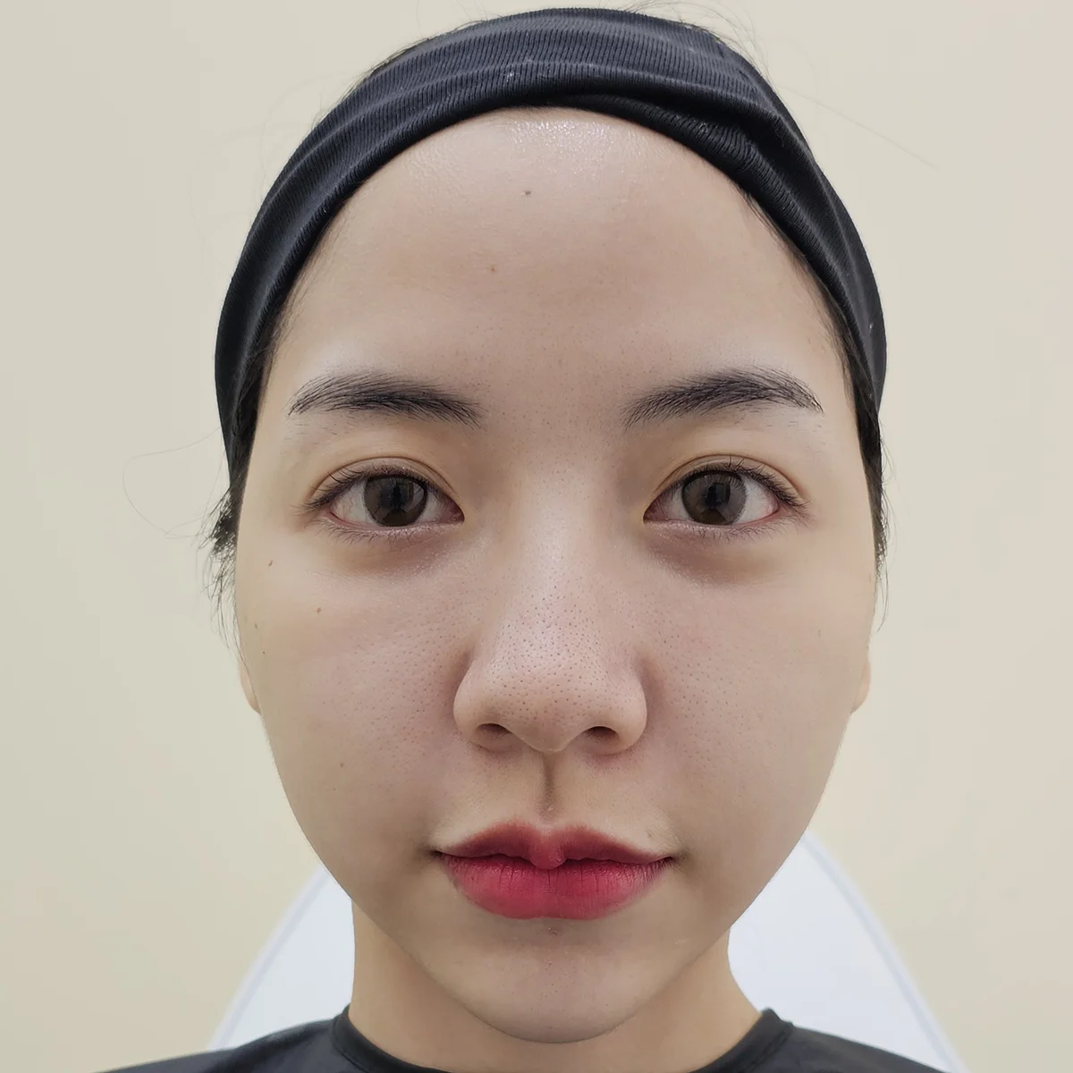 3 เหตุผลที่คุณควรลอง D' Mapen หากคุณมีปัญหารูขุมขนกว้างและรอยสิว