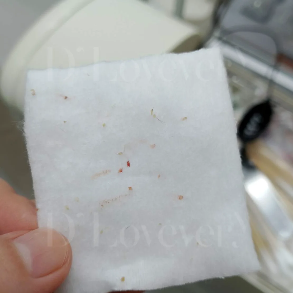 สิววัยรุ่นผู้ชาย รักษายากจริงไหม เปิดเคสจริงที่ ดีเลิฟเวอรี่คลินิก เคลียร์จบทุกปัญหาสิว