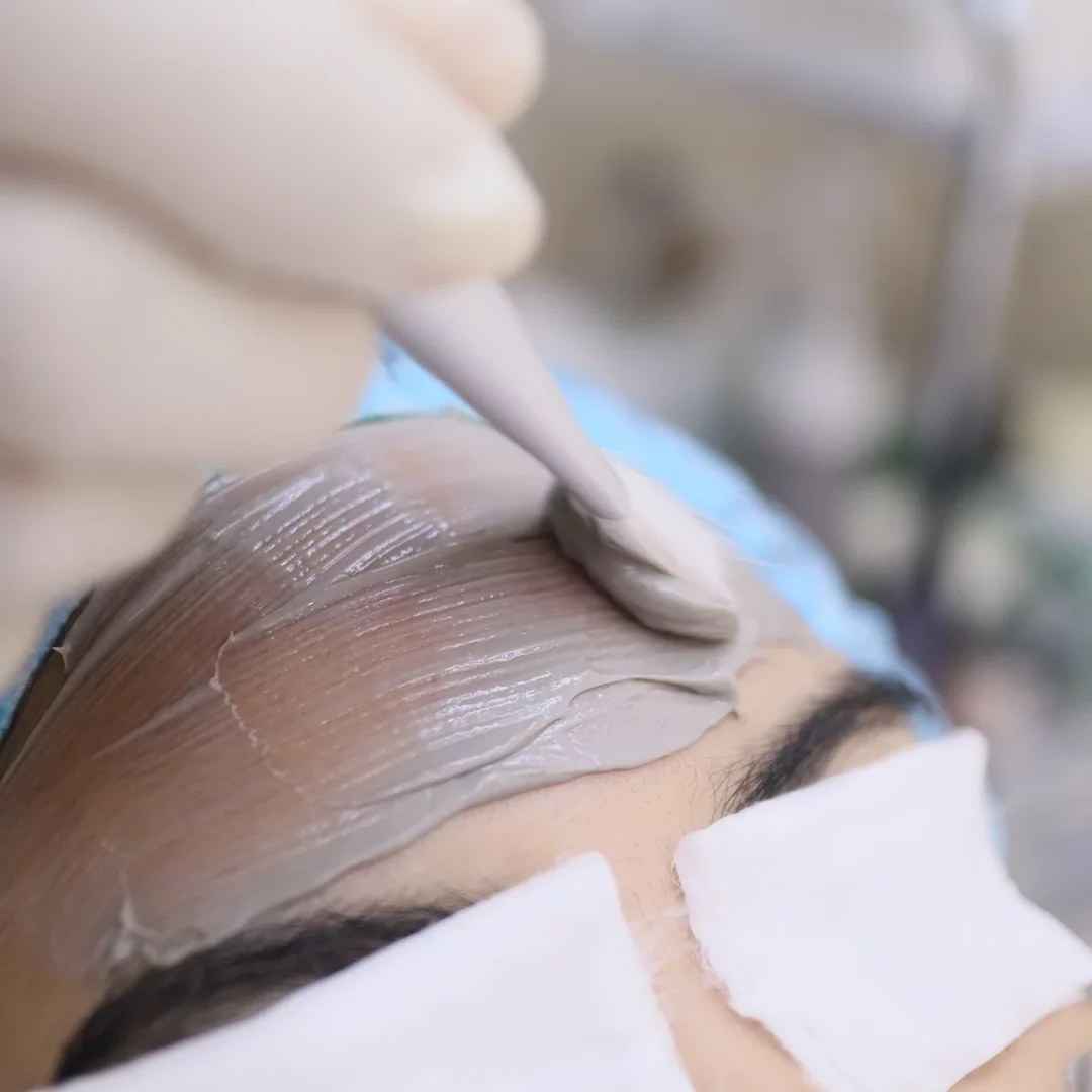 สิวผด สิวอุดตัน หายวับไปกับตา ด้วยเทคนิคผลักวิตามิน 5 ชนิดเข้าสู่ผิว