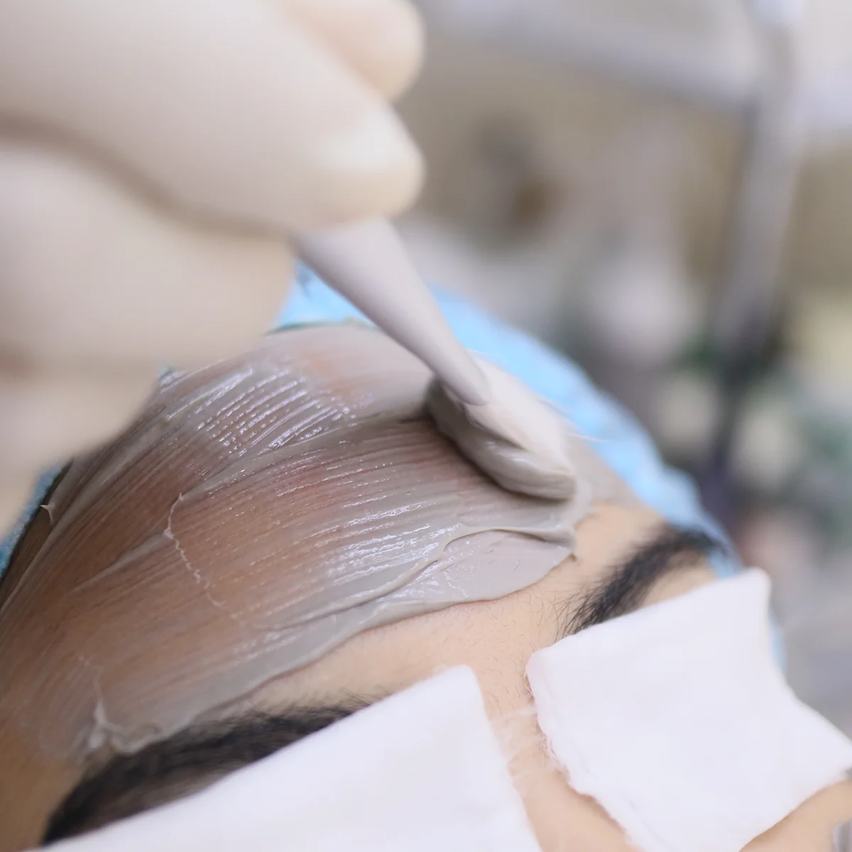 สิวผด สิวอุดตัน หายวับไปกับตา ด้วยเทคนิคผลักวิตามิน 5 ชนิดเข้าสู่ผิว