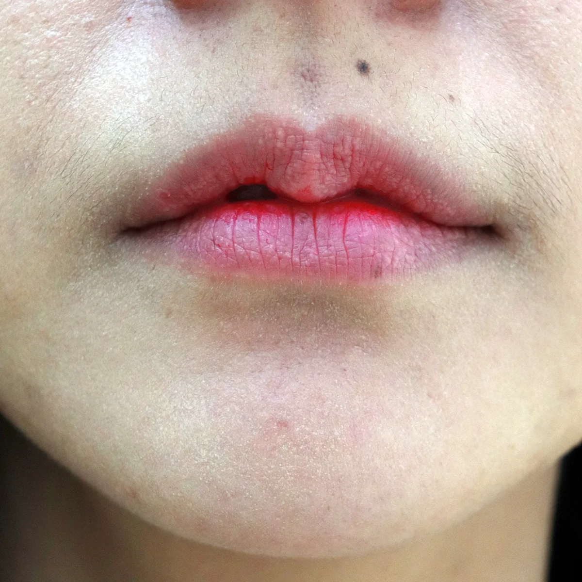 เปลี่ยนปากแห้งบาง ให้เป็นปากฉ่ำวาวน่าจุ๊บง่ายๆ ด้วยฟิลเลอร์