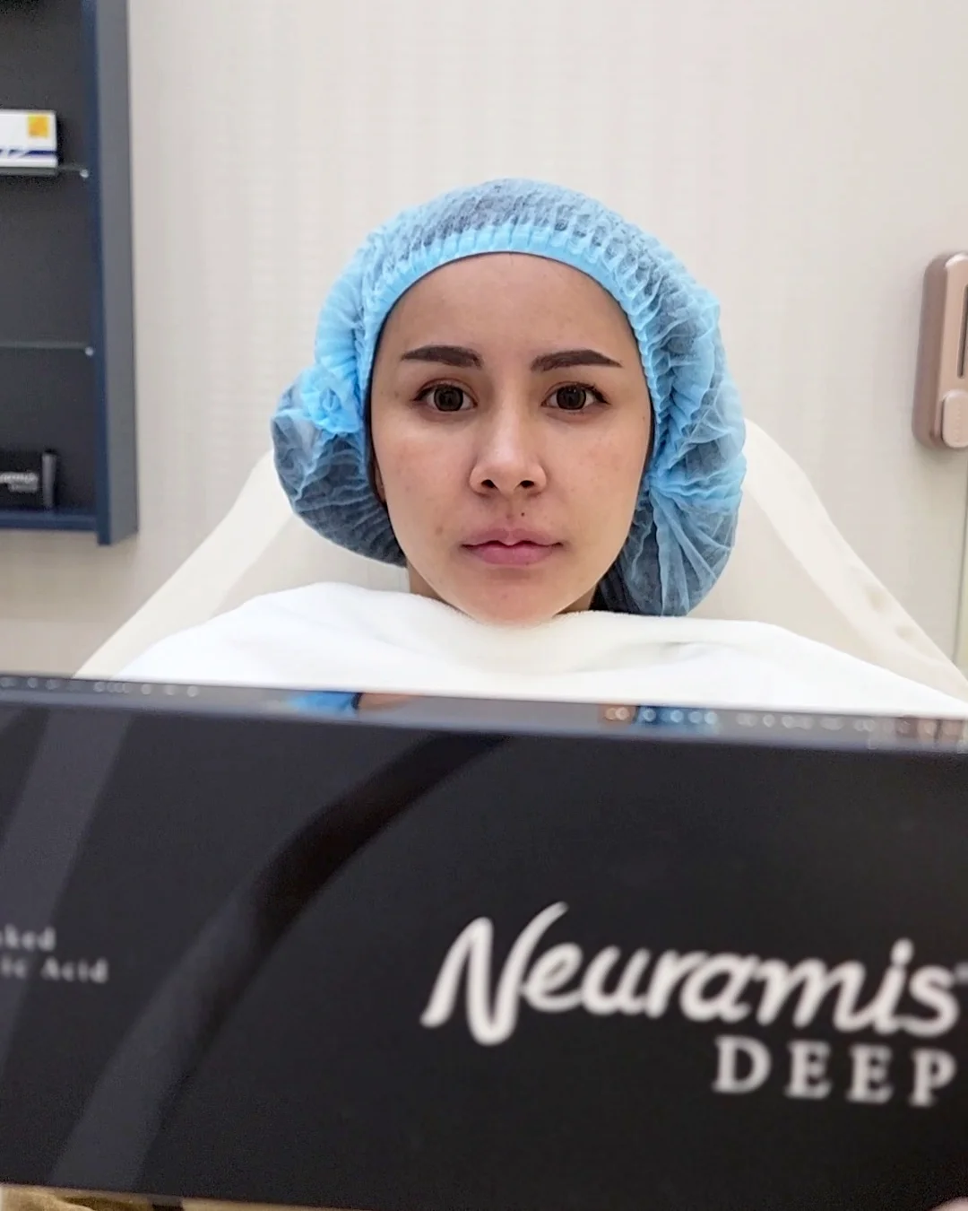 แก้ปัญหาปากคว่ำ หน้าบึ้ง ให้กลับมาสดใสด้วยฟิลเลอร์ปาก