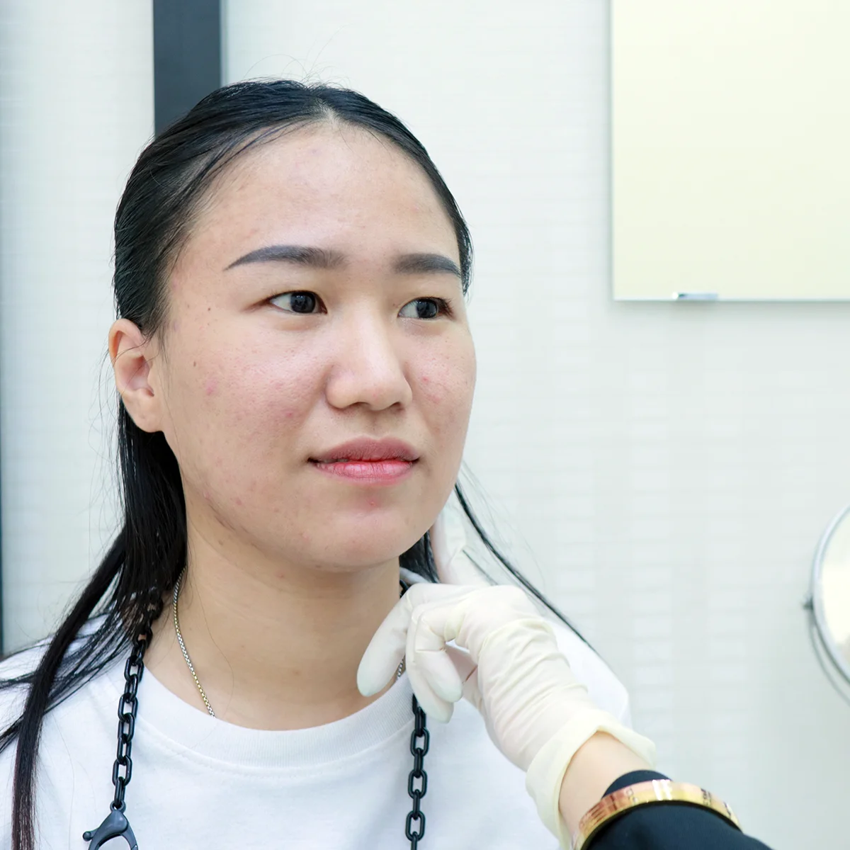 สิวเห่อหนักมาก! ทางออกของคนทำงานที่ต้องเจอผู้คนทุกวัน