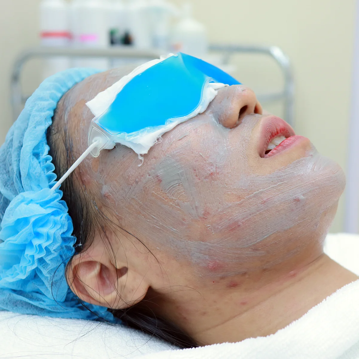 หน้าใสจนเพื่อนทัก! แค่เปลี่ยนวิธีดูแลตัวเองที่ D' Lovevery Clinic