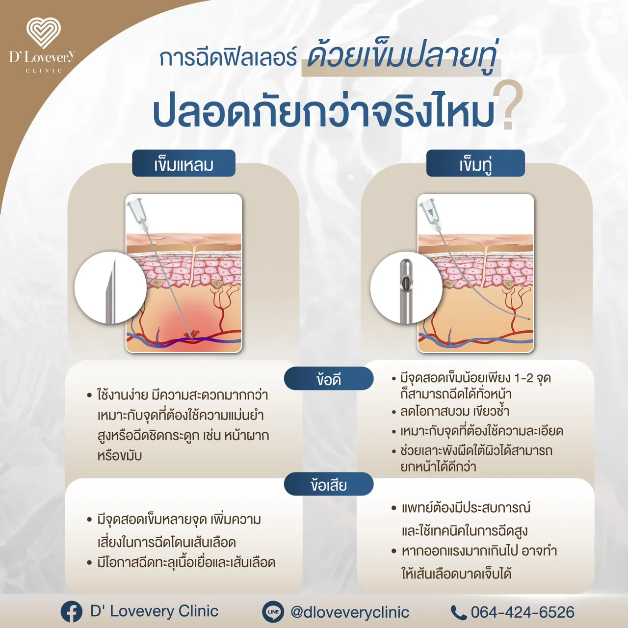 ฉีดฟิลเลอร์ แพทย์ที่ชำนาญจะใช้เข็มปลายทู่ในการเติมฟิลเลอร์ เพื่อลดความเสี่ยงด้านการบวมช้ำ และอื่นๆ