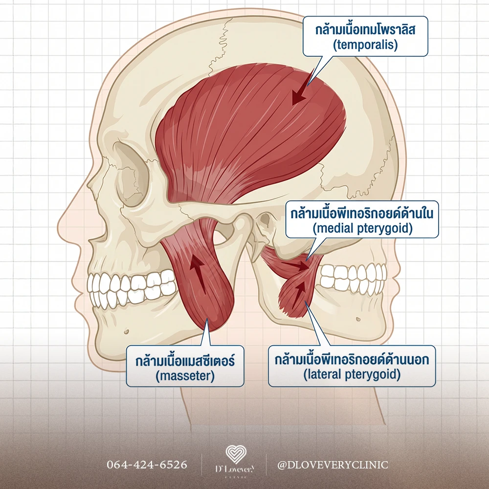 สงสัยไหม? ฉีดโบท็อกซ์แก้กัดฟันกับลดกรามหน้าเรียว เหมือนหรือต่างกัน? หมอสรุปให้ชัด เจาะลึกจุดฉีด ปริมาณยา และผลลัพธ์แบบ 2 in 1 ที่คุณจะได้ พร้อมคำแนะนำจากแพทย์ คลิก!