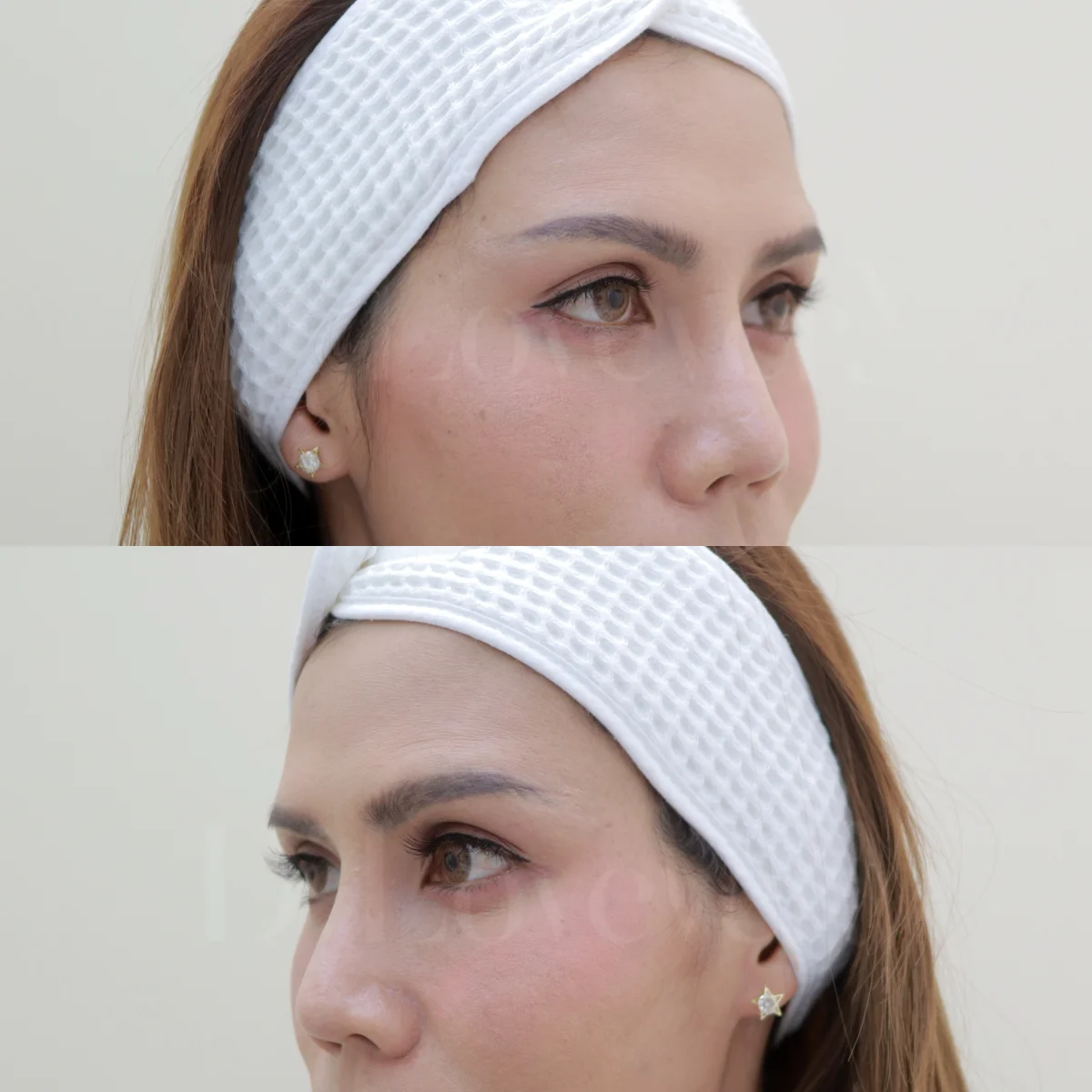 ชาวรามคำแหง-สัมมากร ถูกใจสิ่งนี้! เติมขมับสวยเป๊ะ ราคาดีงาม ใกล้บ้านไม่ต้องฝ่ารถติดเข้าเมือง