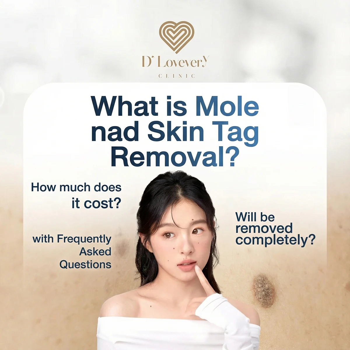 Mole and skin tag removal clinic near me.