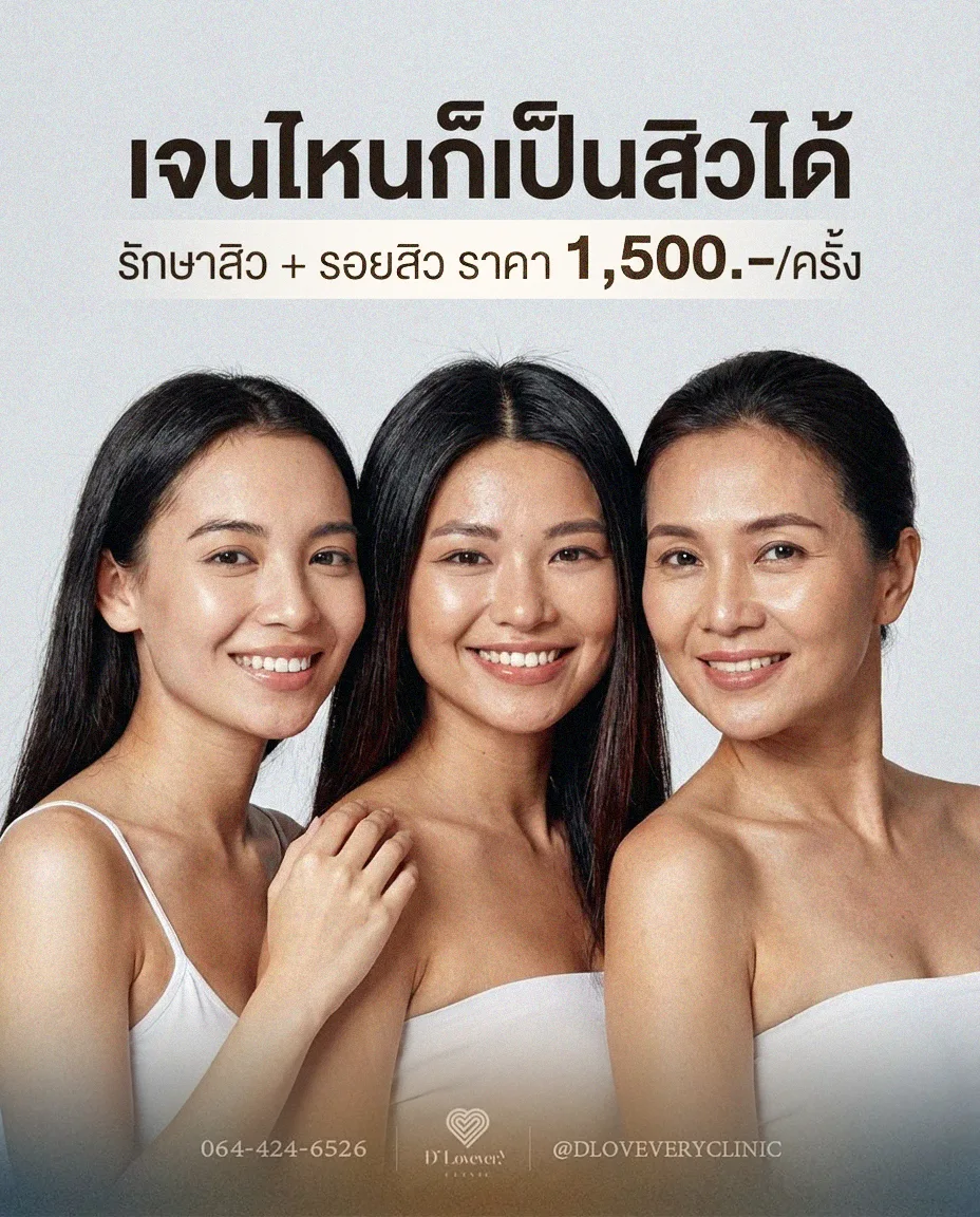 คอร์สรักษาสิวทั่วหน้า + เลเซอร์ลดรอยดำรอยแดง D’ Acne L คุ้มกว่ายังไง เหมาะกับใคร ราคาเท่าไหร่ คำถามที่พบบ่อย