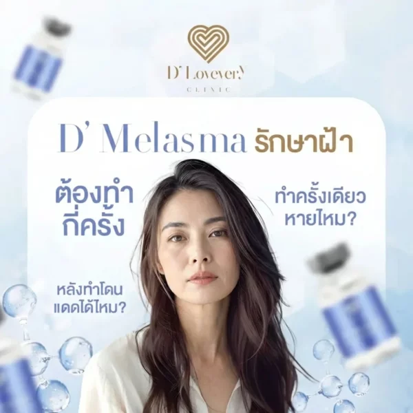 D’ Melasma รักษาฝ้า คืออะไร ต้องทำกี่ครั้ง ฝ้าจะหายถาวรไหม ราคาเท่าไหร่ คำถามที่พบบ่อย