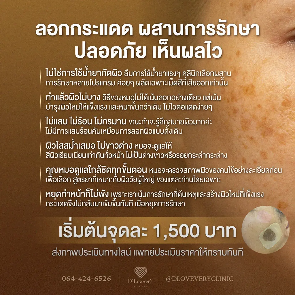 กังวลเรื่องฝ้าและกระแดดขนาดใหญ่ใช่ไหม? ค้นพบวิธีลอกฝ้า ลอกกระ ที่เห็นผลจริงและปลอดภัยที่ D’ Lovevery Clinic ผิวเรียบเนียน ไม่บาง ไม่ทำร้ายผิว โดยหมอต้าร์และทีมงานมืออาชีพ