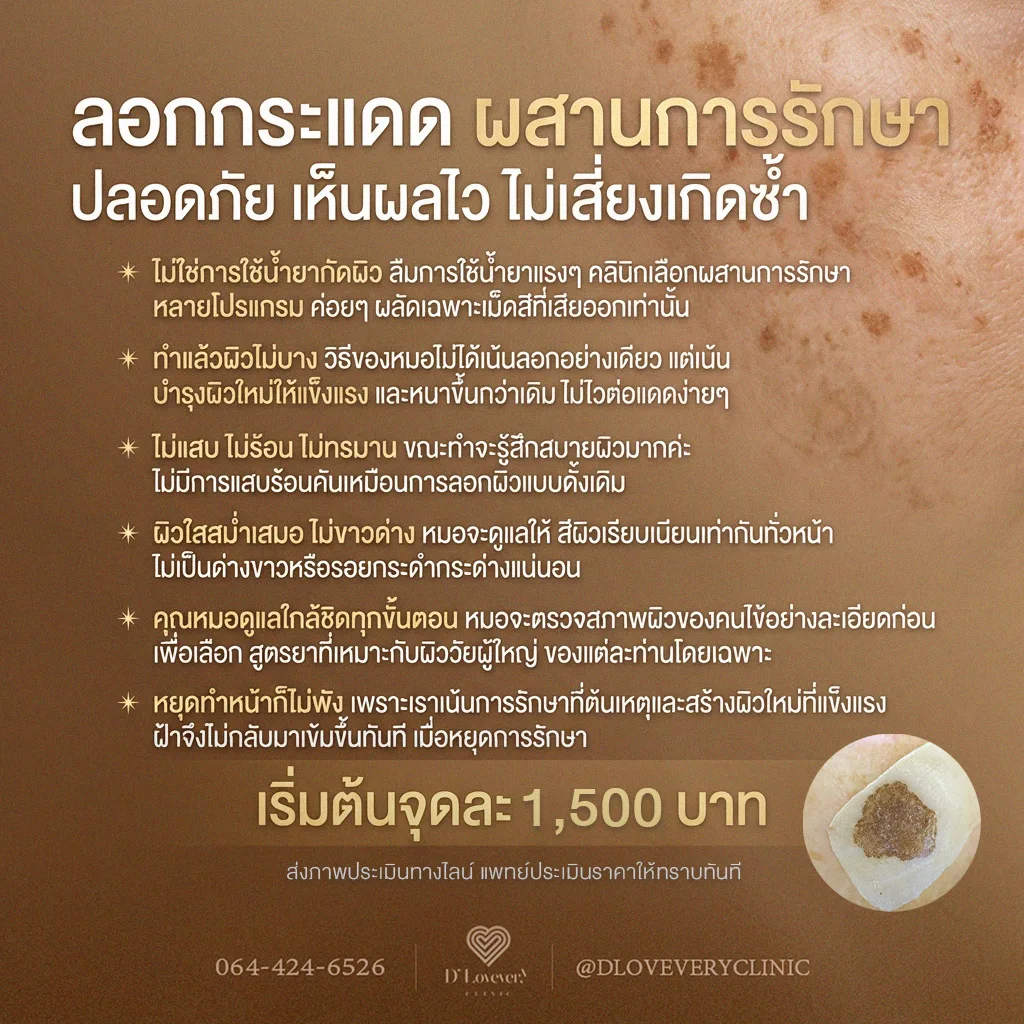 กังวลเรื่องฝ้าและกระแดดขนาดใหญ่ใช่ไหม? ค้นพบวิธีลอกฝ้า ลอกกระ ที่เห็นผลจริงและปลอดภัยที่ D’ Lovevery Clinic ผิวเรียบเนียน ไม่บาง ไม่ทำร้ายผิว โดยหมอต้าร์และทีมงานมืออาชีพ