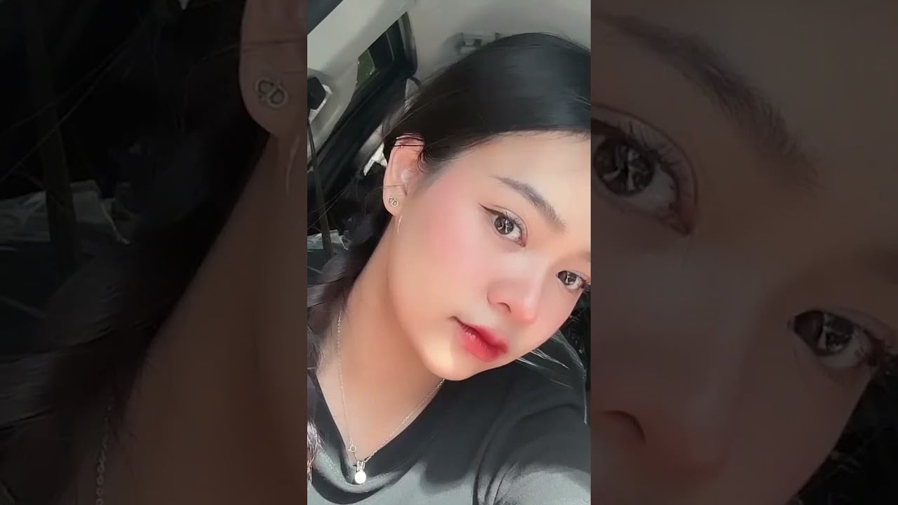 ฟิลเลอร์ปาก เติมความน่ารักสดใสให้ใบหน้า ด้วยฟิลเลอร์ริมฝีปากอวบอิ่ม