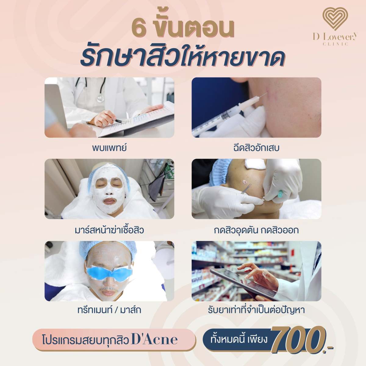 6-step acne treatment at D Lovely Clinic: consultation, procedures, topical meds — 700 THB