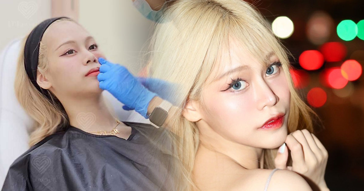 รีวิวฉีดไหมน้ำใต้ตา-ultracol-D'-Lovevery-clinic