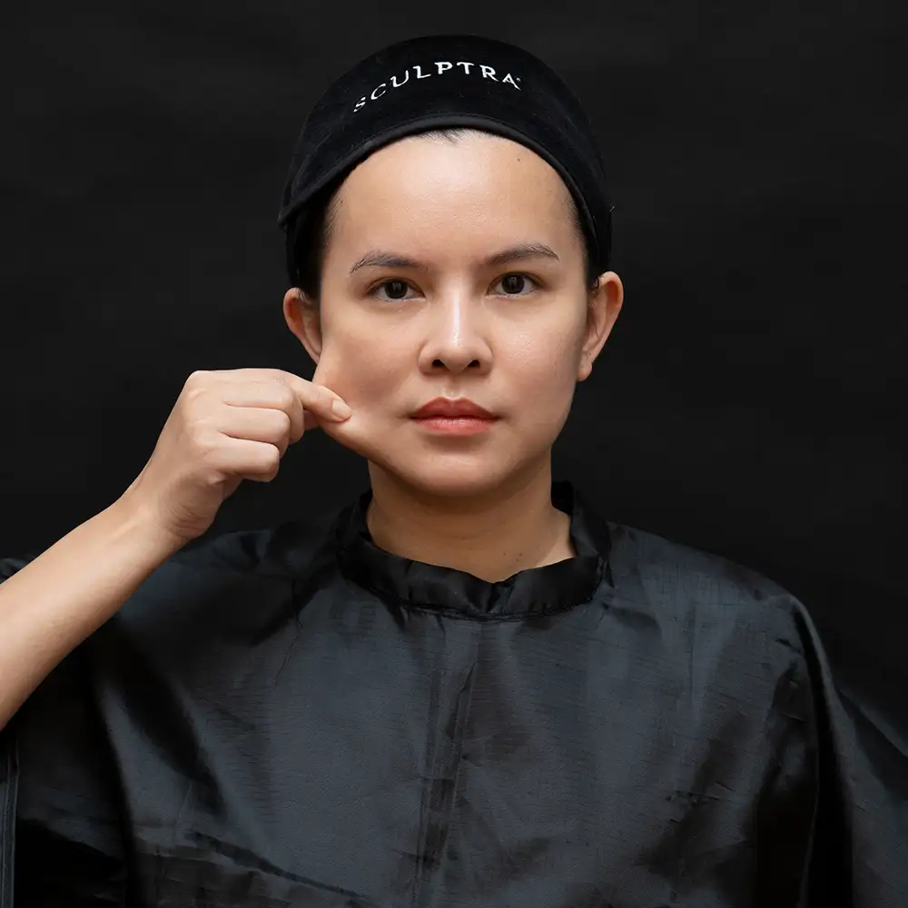 Sculptra Cheek Showcase Dlovevery