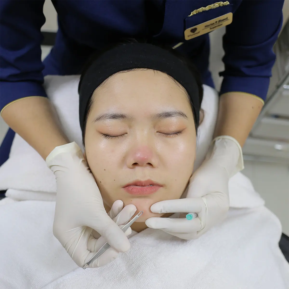 ขั้นตอนที่ 2 กดสิวทั่วใบหน้า