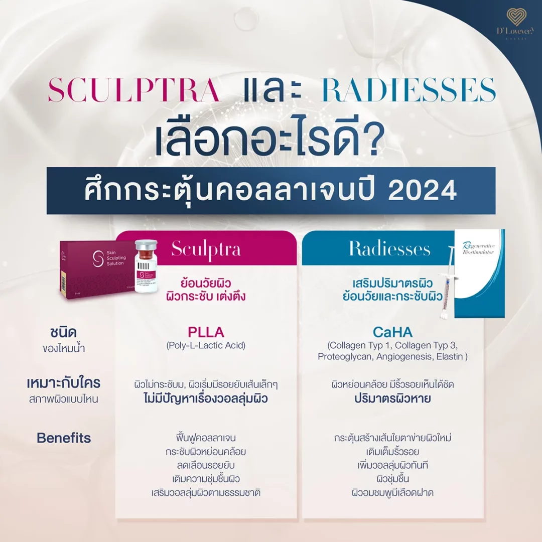 sculptra vs radiesse