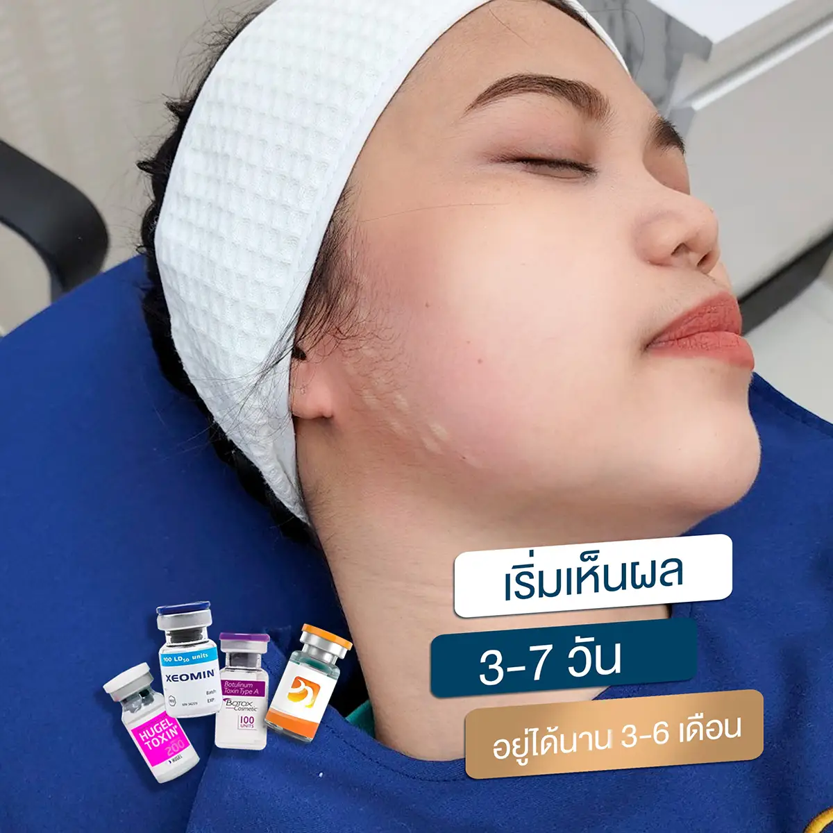 โบท็อกซ์กี่วันเห็นผล หมอต้าร์