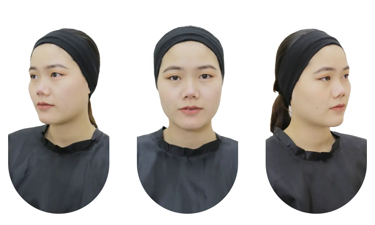 ส่งภาพประเมินทรีทเมนท์หน้า