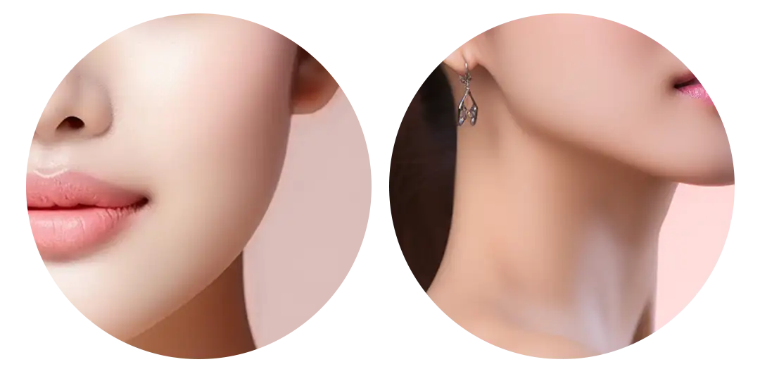 HIFU หัว 4.5mm