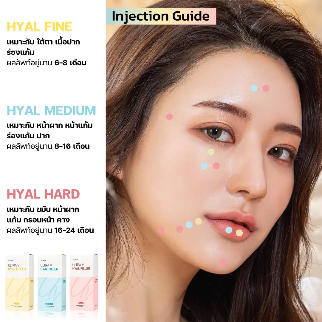 ultra V Hyal filler ฉีดตรงไหนได้บ้าง