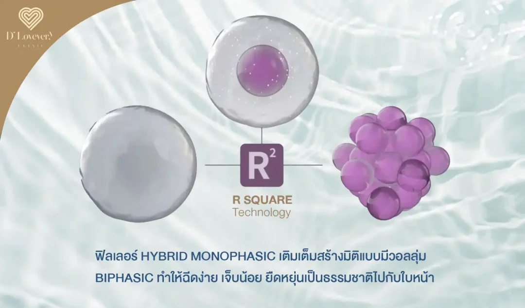 ultra V Hyal filler ดียังไง