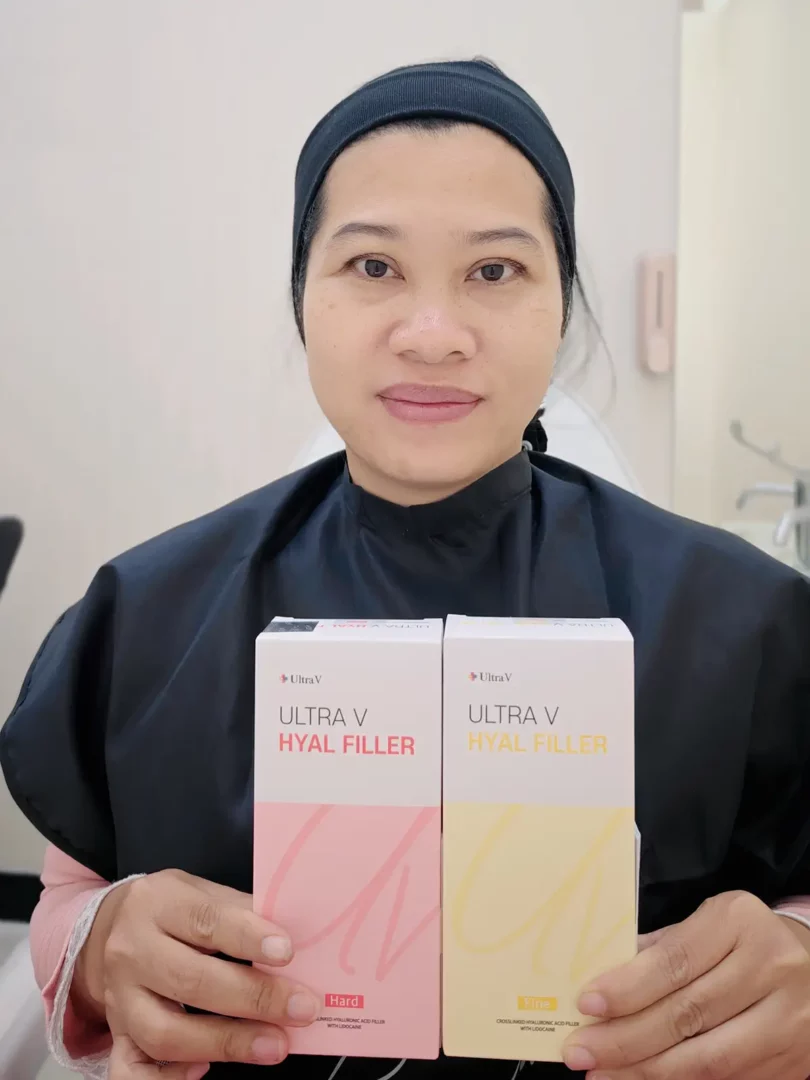 รีวิวฉีดฟิลเลอร์ใต้ตา ultra v hyal filler หมอต้าร์