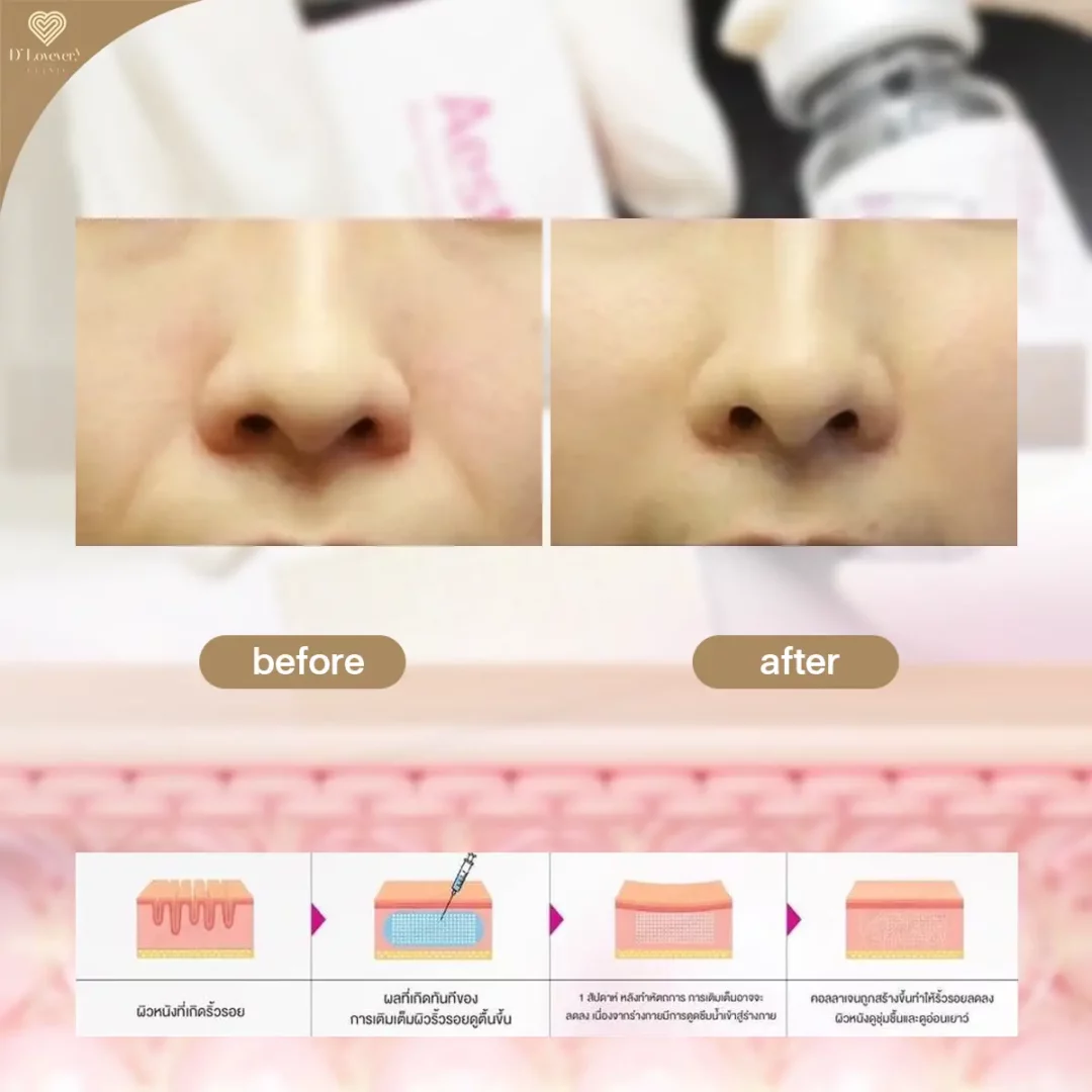 aesthefill รีวิว