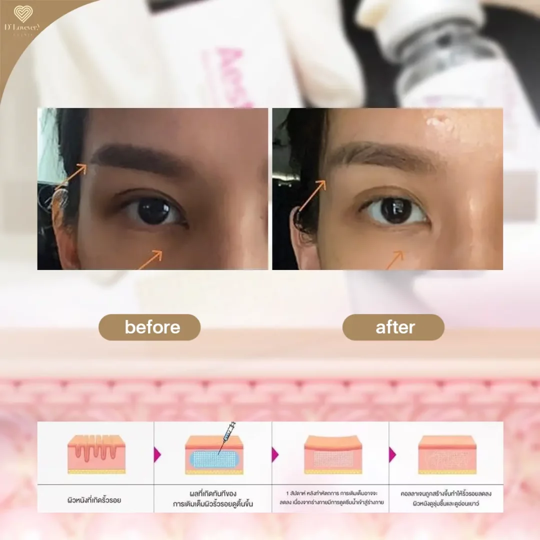 aesthefill รีวิว