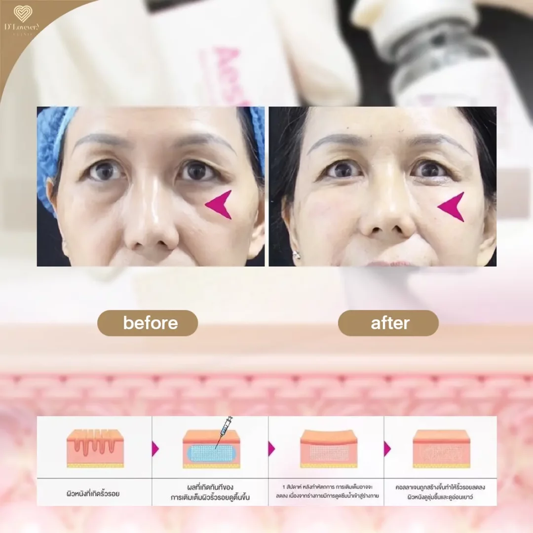 aesthefill รีวิว