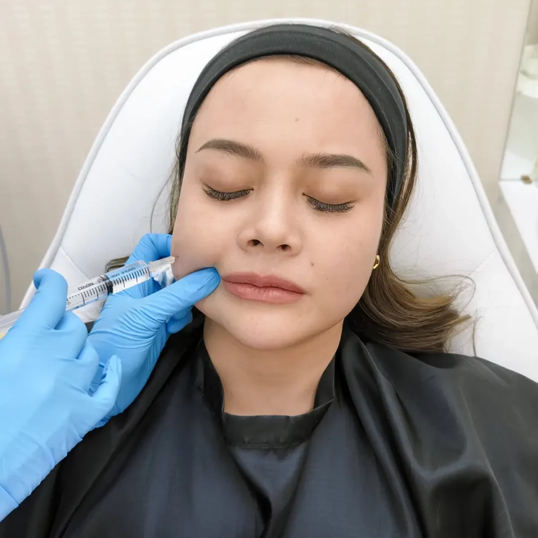 Cheek fat-dissolve injection for facial contouring by clinician in blue gloves
