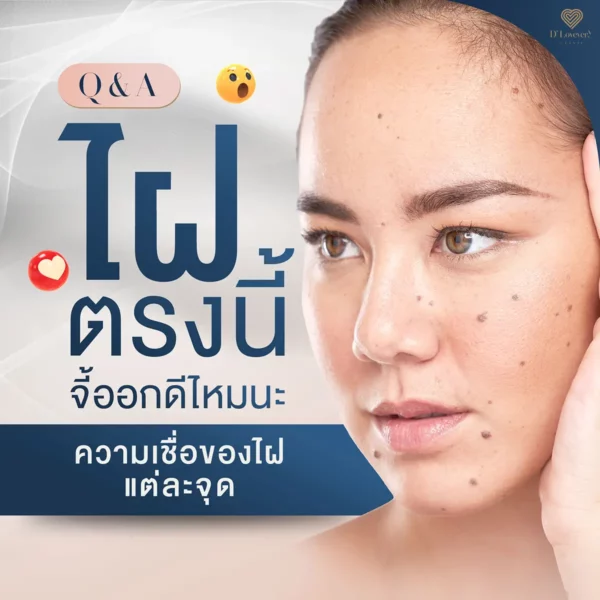 Close-up woman with facial moles beside mole removal Q&A clinic graphic