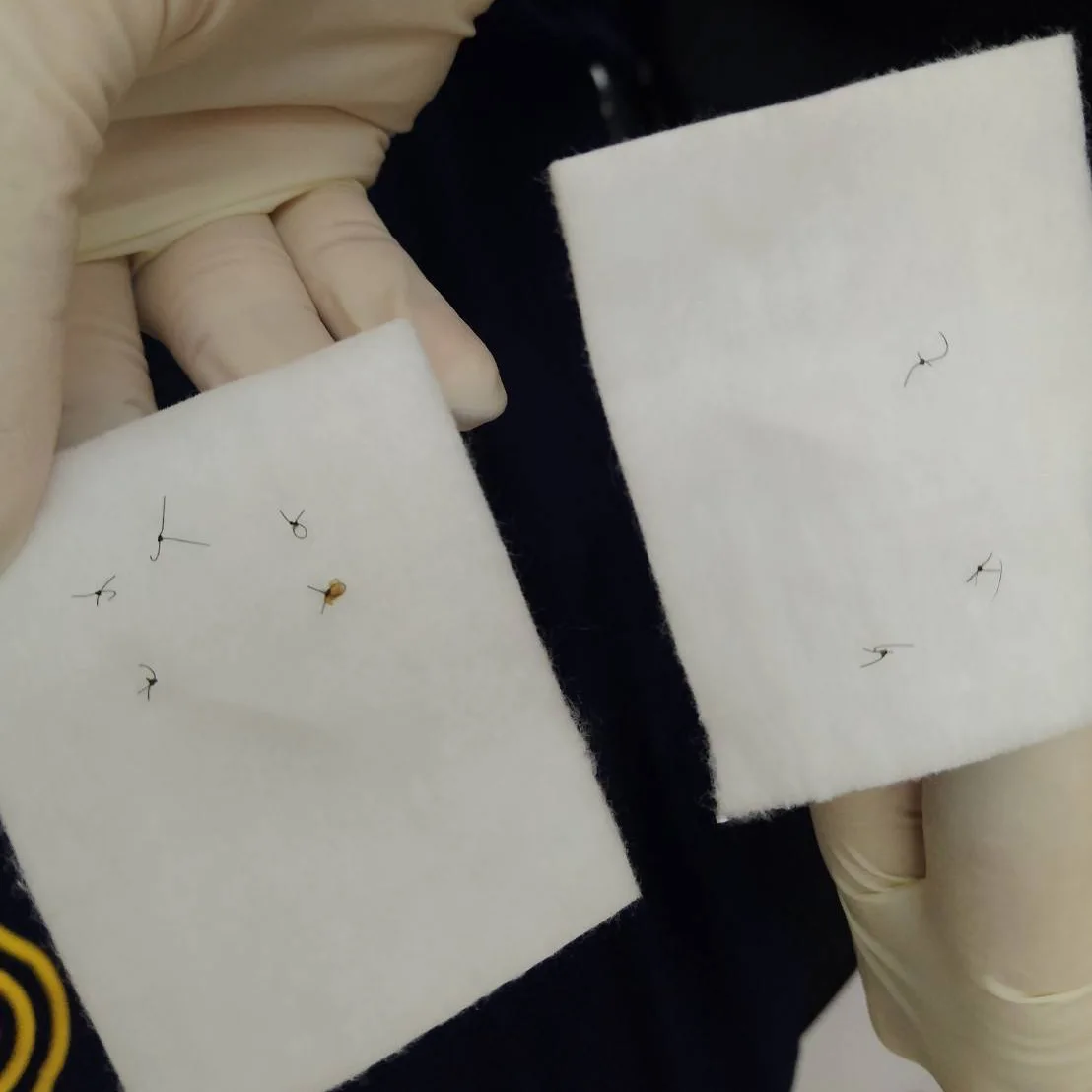 Suture removal gauze showing hair and crust debris