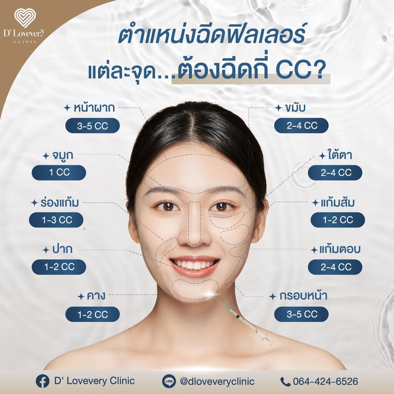 Facial filler zones infographic showing recommended CC per area