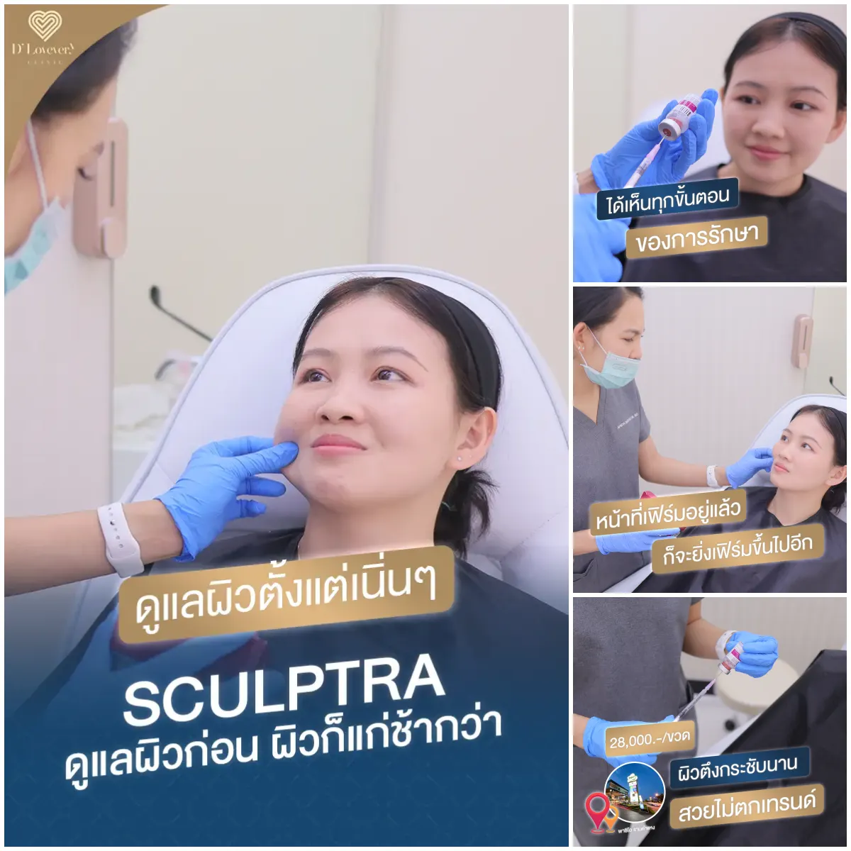 Sculptra review: Before and after treatment.