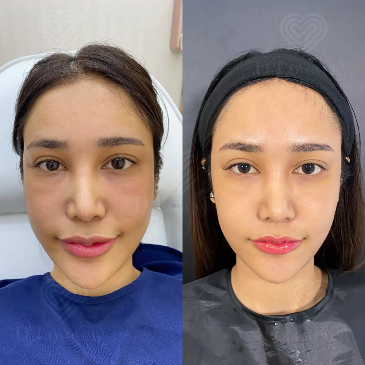รีจูรัน รีวิว