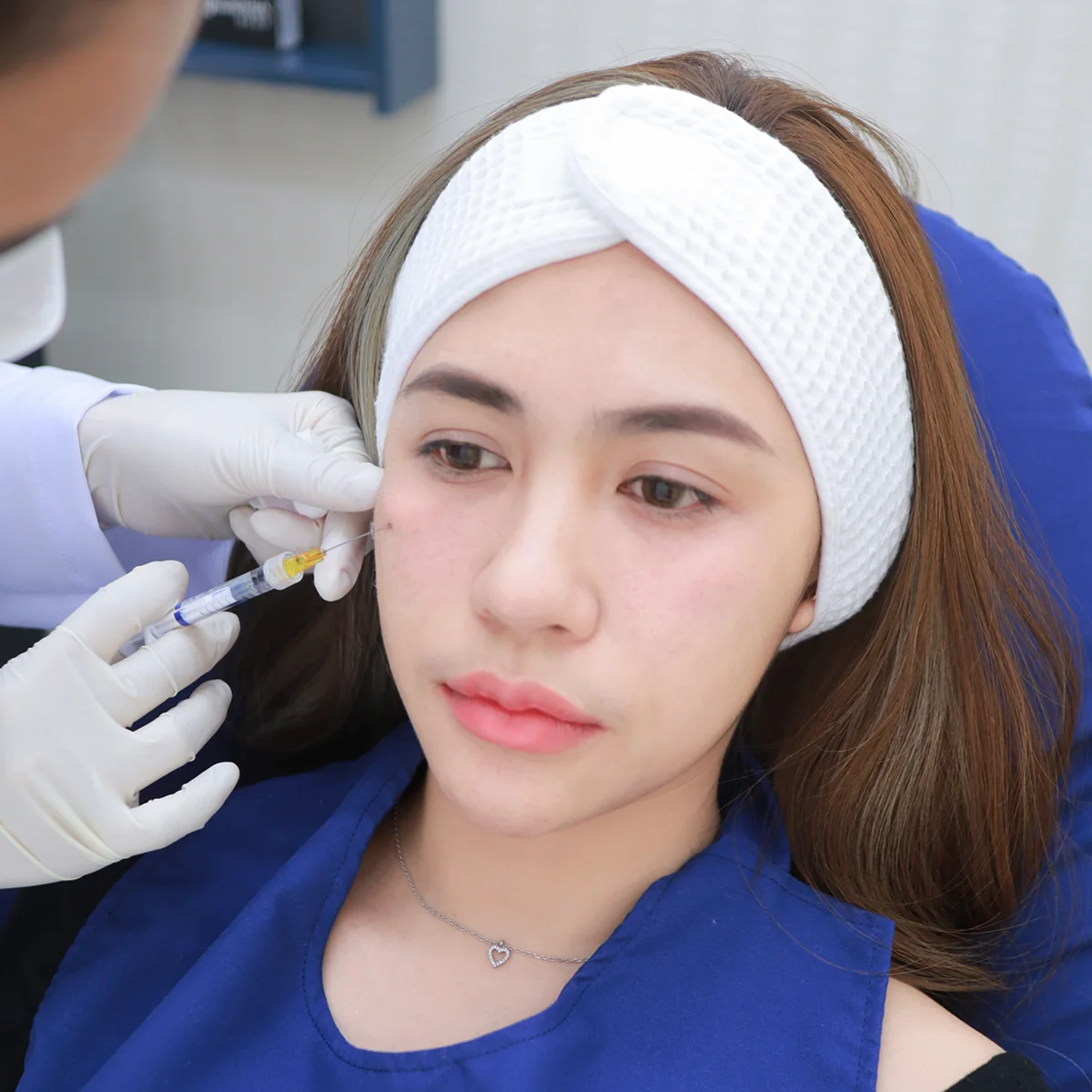 Before After Under Eyes Filler Miss Mook 4