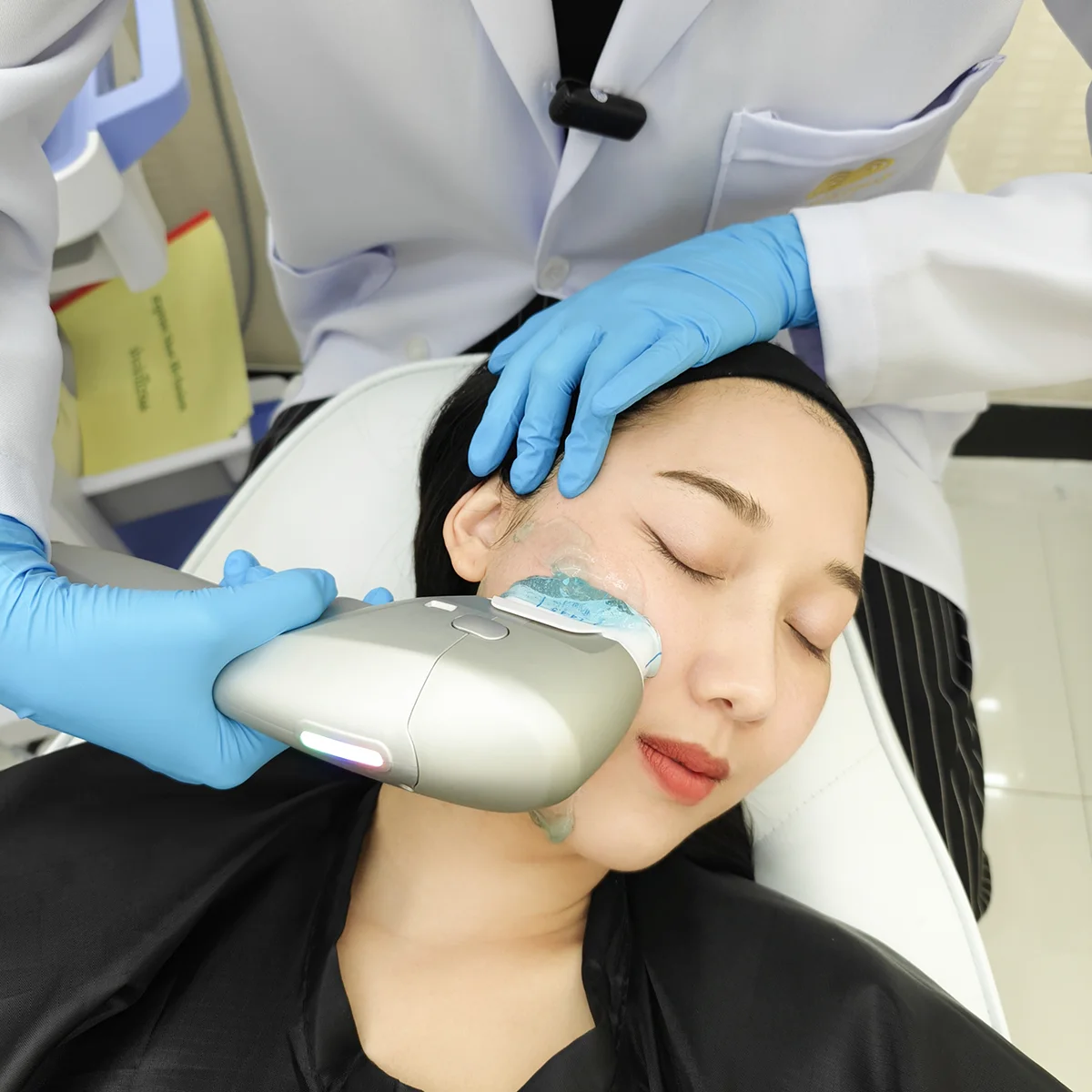 HIFU cheek treatment with handheld device and cooling gel in cosmetic clinic