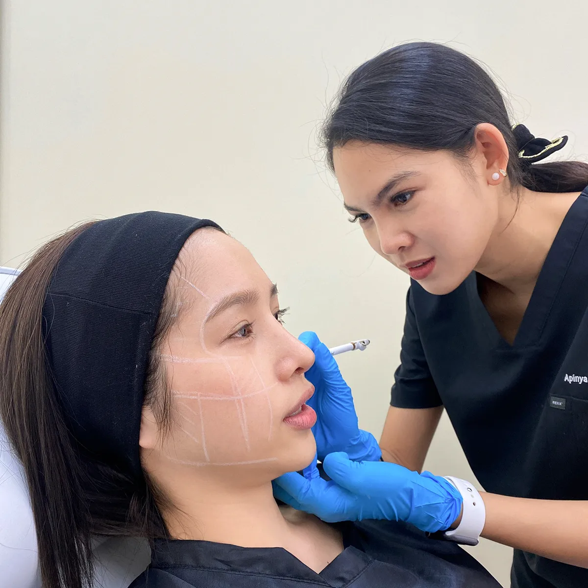 รีวิว sculptra