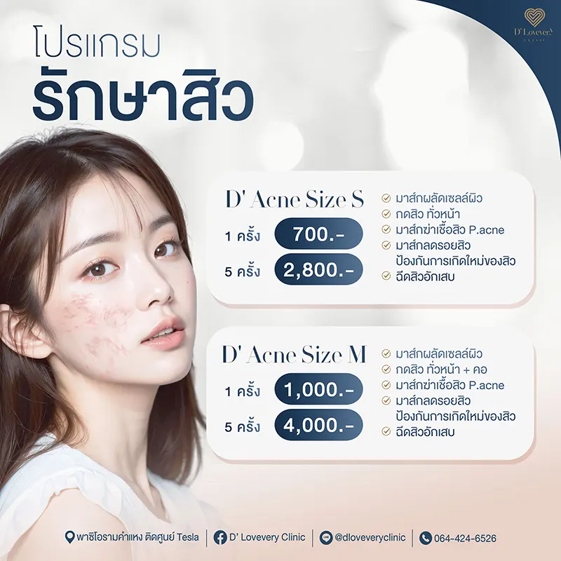 โปรแกรมรักษาสิว ราคาเท่าไหร่ d-acne-size-s-m