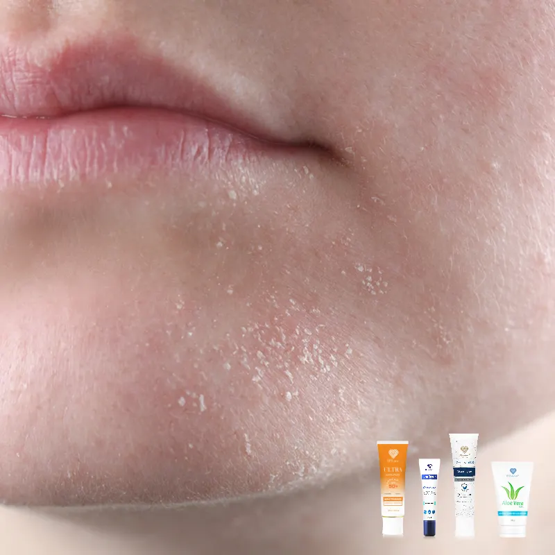 Close-up of dry, flaky chin skin with skincare product tubes