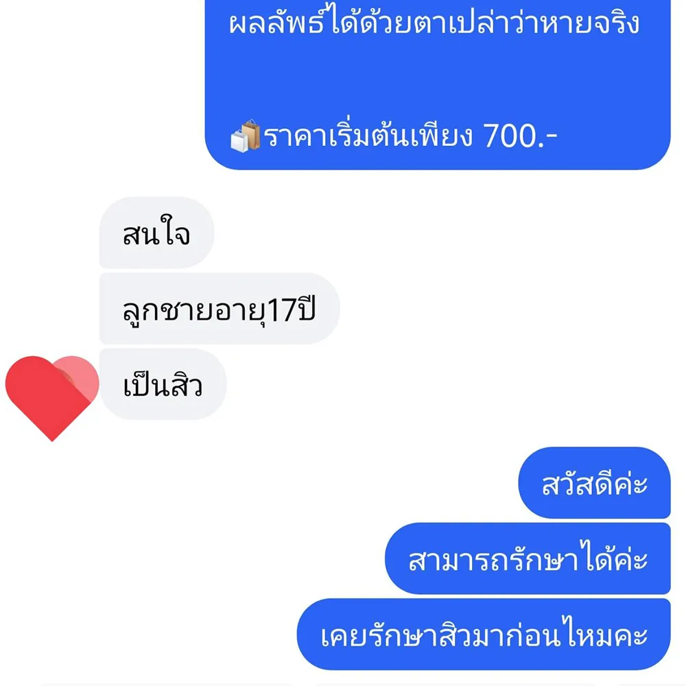 ลูกค้าอายุ 17 เป็นสิว