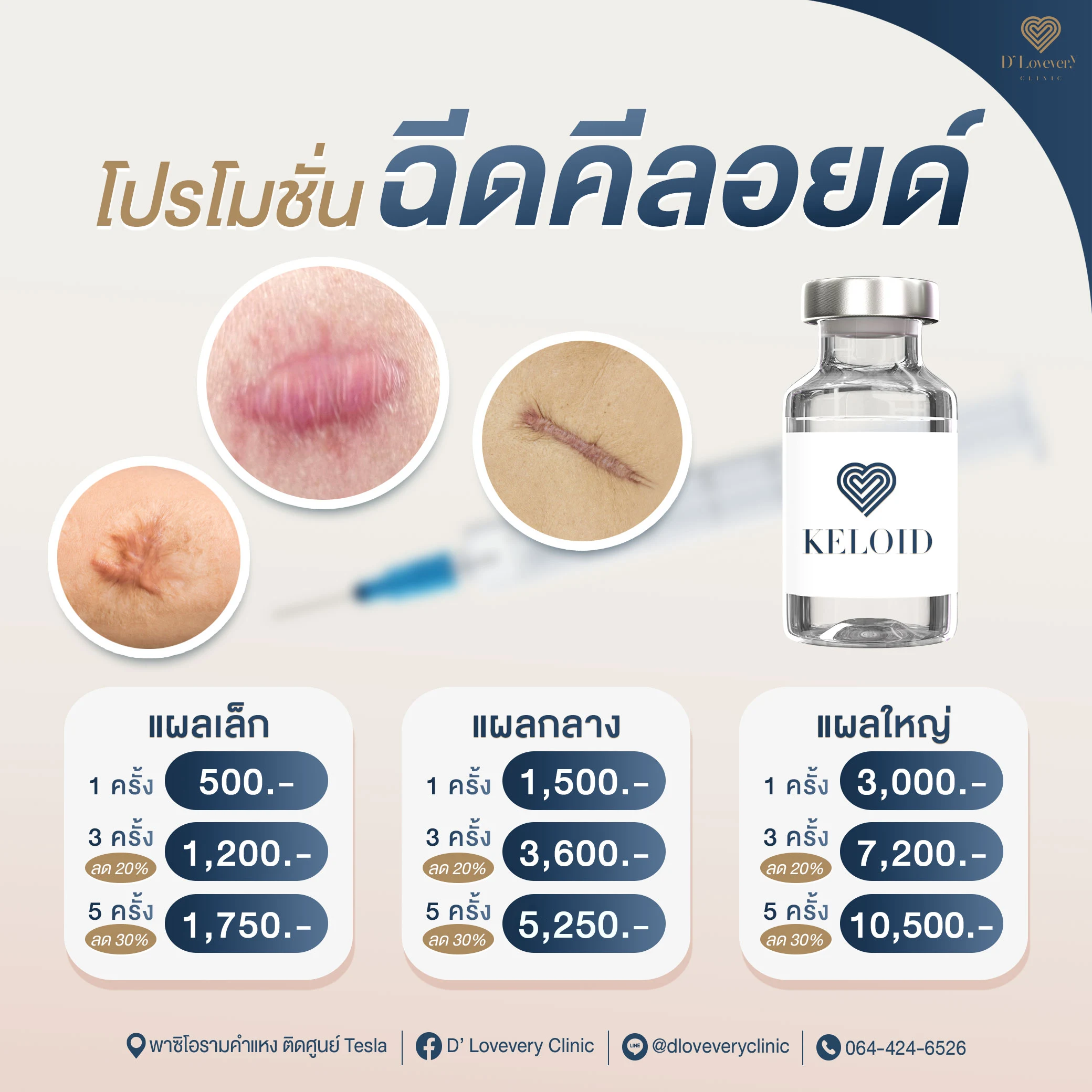 Keloid injection pricing and packages — D Lovevery Clinic