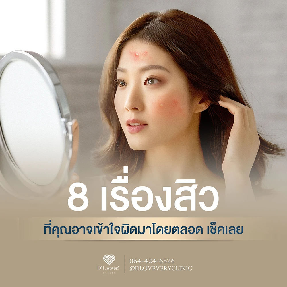 8 เรื่องเข้าใจผิด เกี่ยวกับการรักษาสิว