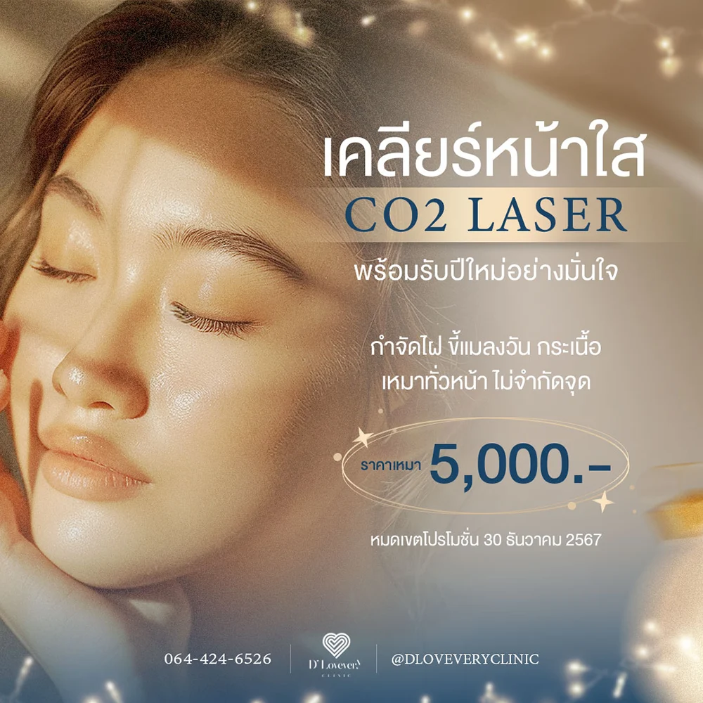 เลเซอร์กำจัดไฝ ขี้แมลงวัน กระเนื้อ ราคาเหมา co2 laser