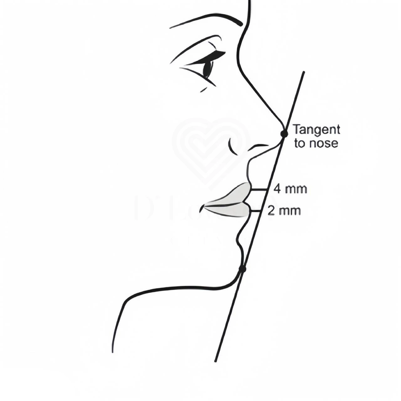 E-lines-filler-chin dlovevery clinic